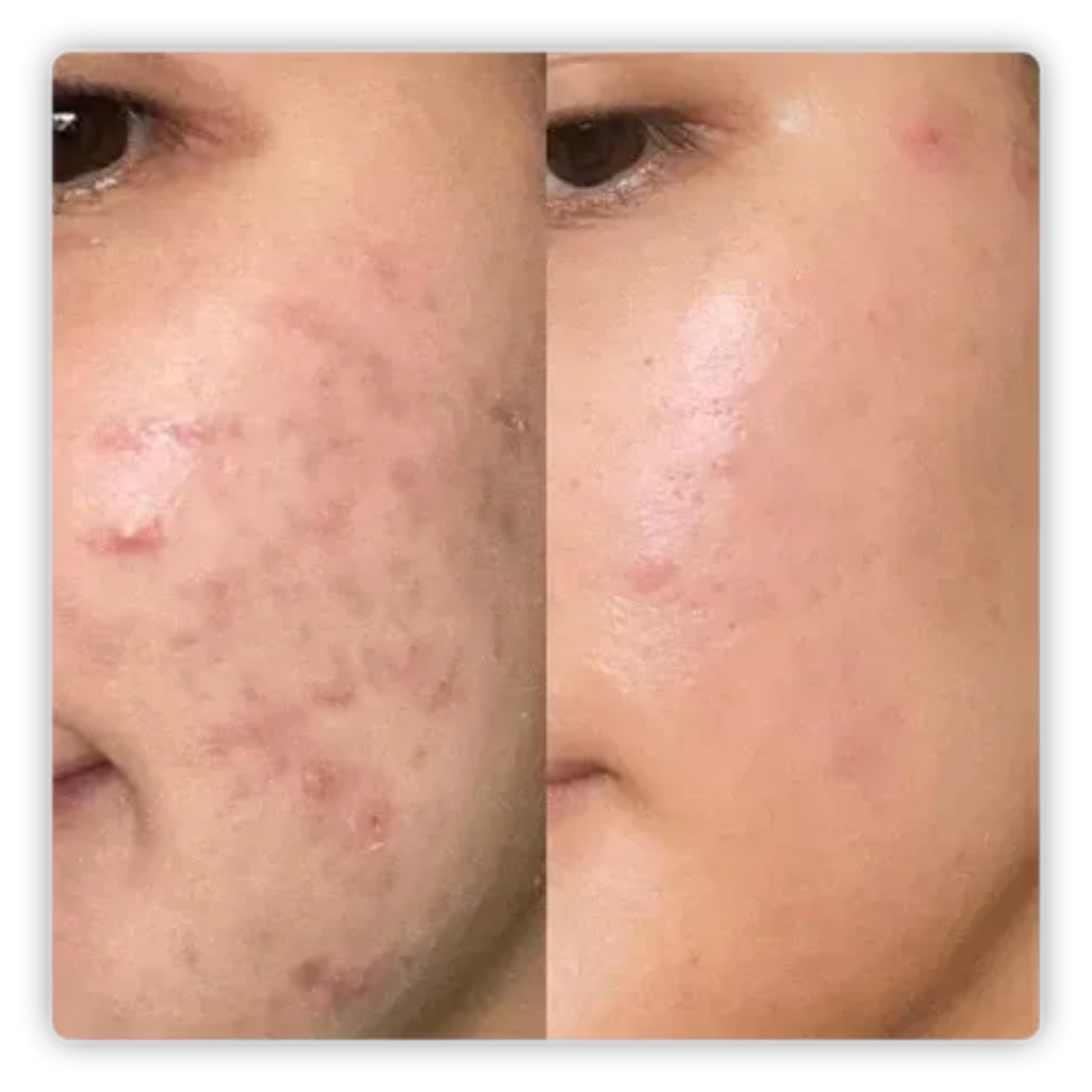 ALMOHADILLAS NATUFIX® - HIDRATA, ILUMINA, CALMA