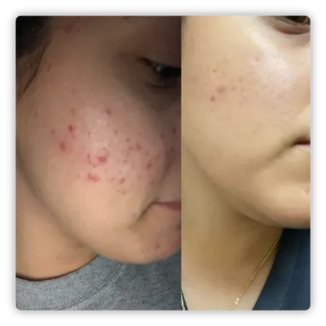 ALMOHADILLAS NATUFIX® - HIDRATA, ILUMINA, CALMA