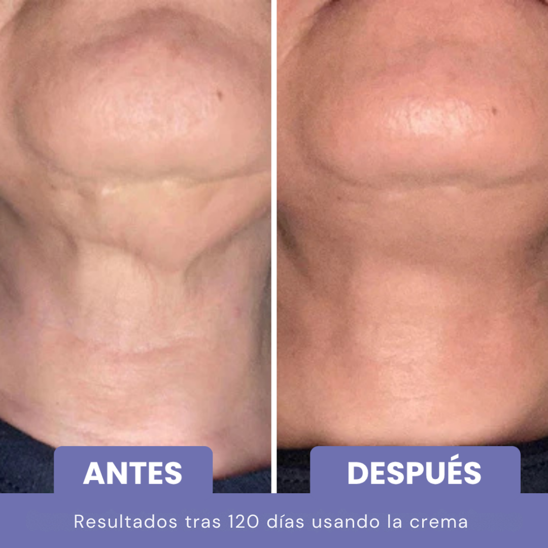 NATUFIX® - CREMA REAFIRMANTE Y TONIFICANTE PARA EL CUELLO