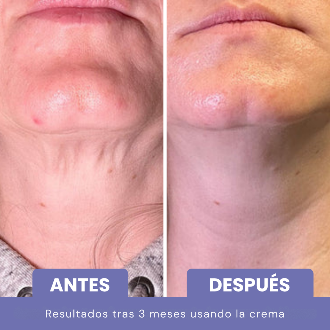 NATUFIX® - CREMA REAFIRMANTE Y TONIFICANTE PARA EL CUELLO