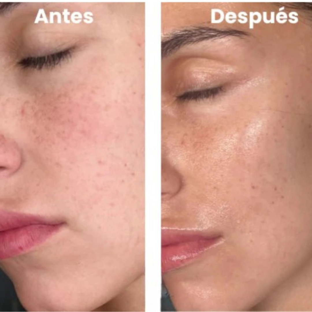 NATUFIX® - MASCARILLA COLAGENO + REGALO ESPECIAL