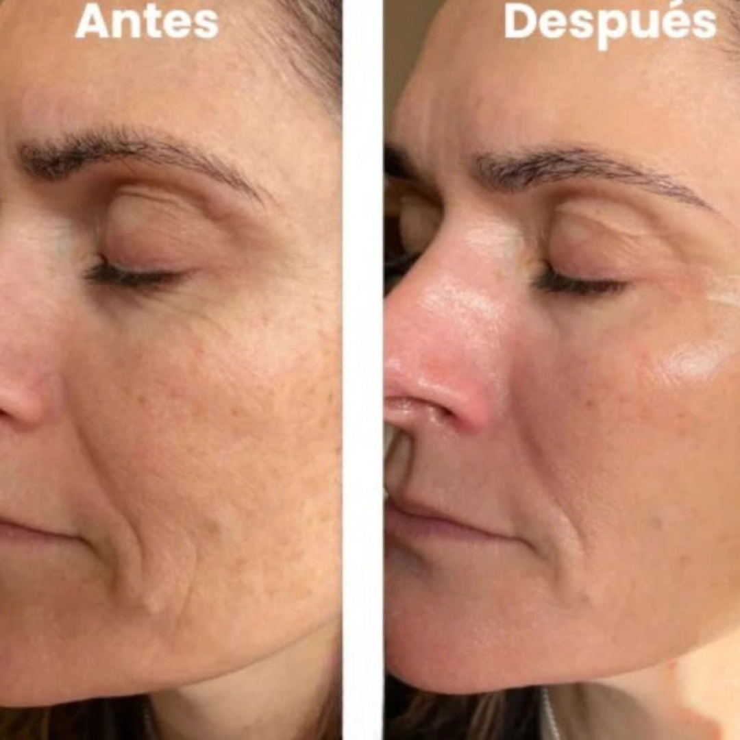 NATUFIX® - MASCARILLA COLAGENO + REGALO ESPECIAL