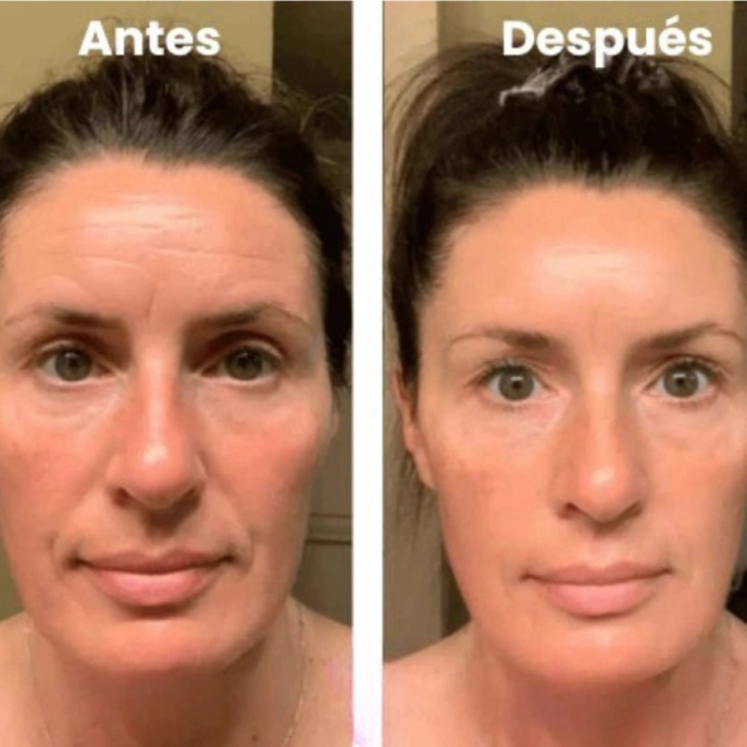 NATUFIX® - MASCARILLA COLAGENO + REGALO ESPECIAL