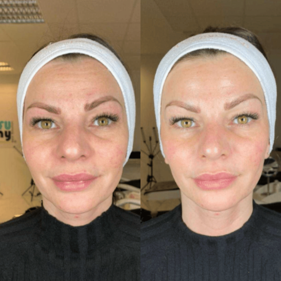 NATUFIX® - MASCARILLA COLAGENO + REGALO ESPECIAL