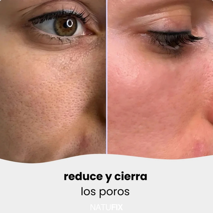 ALMOHADILLAS NATUFIX® - HIDRATA, ILUMINA, CALMA