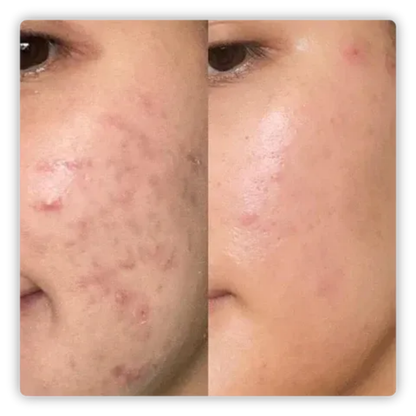 ALMOHADILLAS NATUFIX® - HIDRATA, ILUMINA, CALMA
