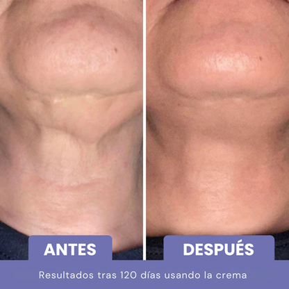NATUFIX® - CREMA REAFIRMANTE Y TONIFICANTE PARA EL CUELLO
