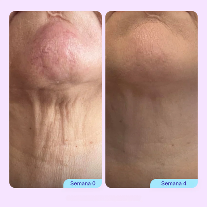 NATUFIX™ — BODY CONFIDENCE SET