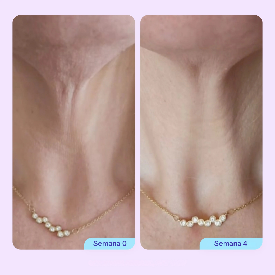 NATUFIX™ — BODY CONFIDENCE SET