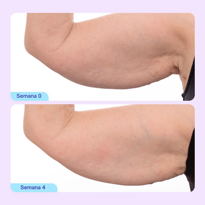 NATUFIX™ — BODY CONFIDENCE SET