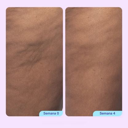 NATUFIX™ — BODY CONFIDENCE SET