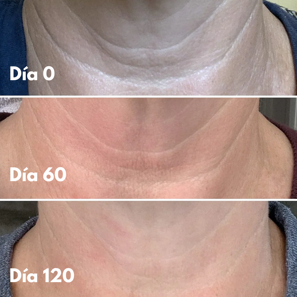 NATUFIX® - CREMA REAFIRMANTE Y TONIFICANTE PARA EL CUELLO