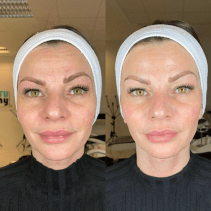 NATUFIX® - MASCARILLA COLAGENO + REGALO ESPECIAL